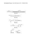 Minimally Invasive Lung Volume Reduction Devices, Methods, and Systems diagram and image