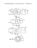 Minimally Invasive Lung Volume Reduction Devices, Methods, and Systems diagram and image