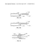 Minimally Invasive Lung Volume Reduction Devices, Methods, and Systems diagram and image