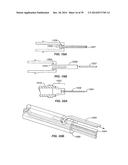 Minimally Invasive Lung Volume Reduction Devices, Methods, and Systems diagram and image