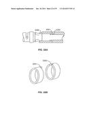 Minimally Invasive Lung Volume Reduction Devices, Methods, and Systems diagram and image