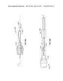 Minimally Invasive Lung Volume Reduction Devices, Methods, and Systems diagram and image