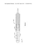 Minimally Invasive Lung Volume Reduction Devices, Methods, and Systems diagram and image