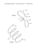 Minimally Invasive Lung Volume Reduction Devices, Methods, and Systems diagram and image