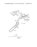 Minimally Invasive Lung Volume Reduction Devices, Methods, and Systems diagram and image