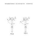 REENTRY CATHETHER AND METHOD THEREOF diagram and image