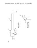 REENTRY CATHETHER AND METHOD THEREOF diagram and image