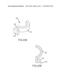 REENTRY CATHETHER AND METHOD THEREOF diagram and image