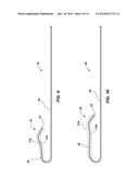 CATHETER AND METHODS RELATED THERETO diagram and image