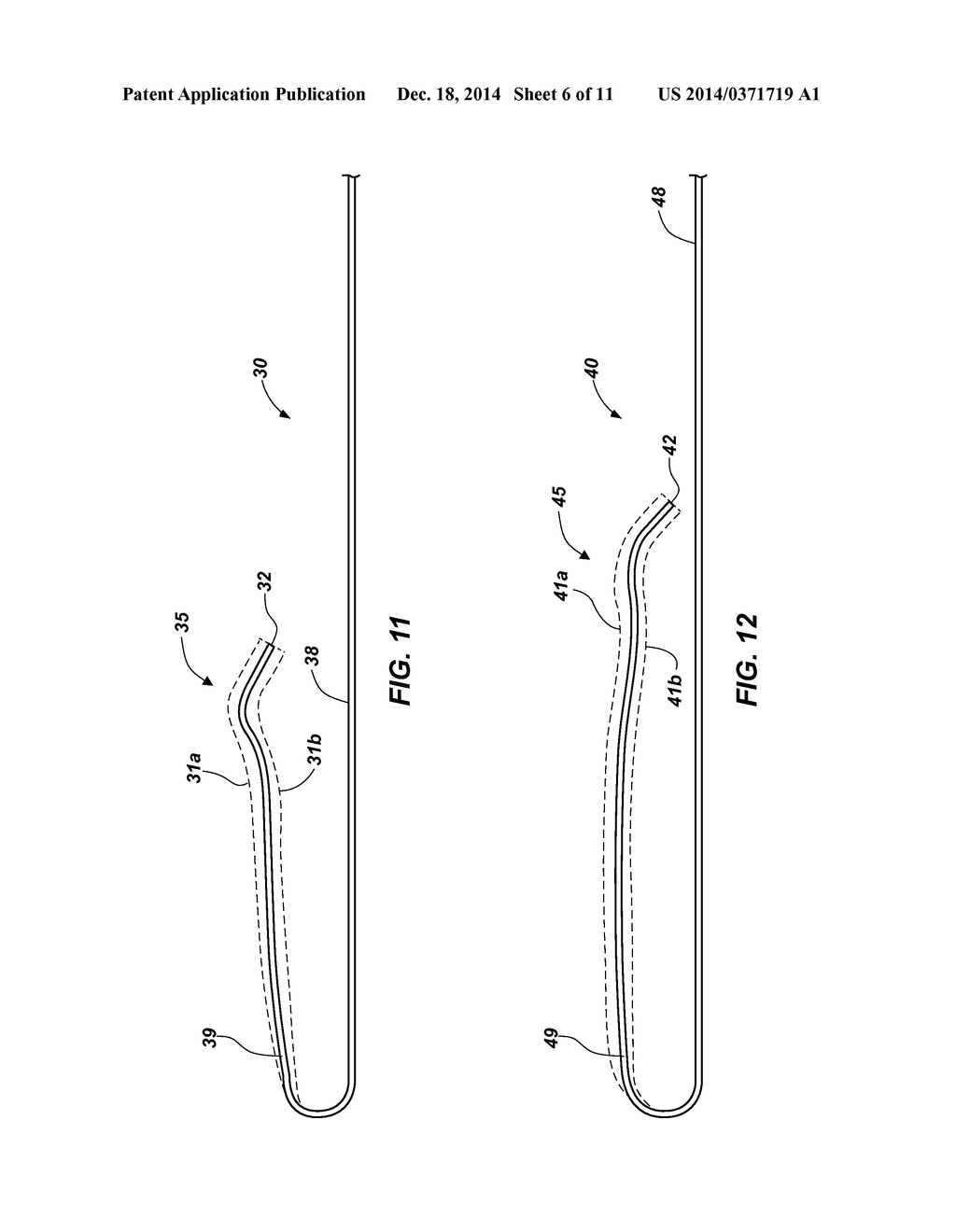 CATHETER AND METHODS RELATED THERETO - diagram, schematic, and image 07