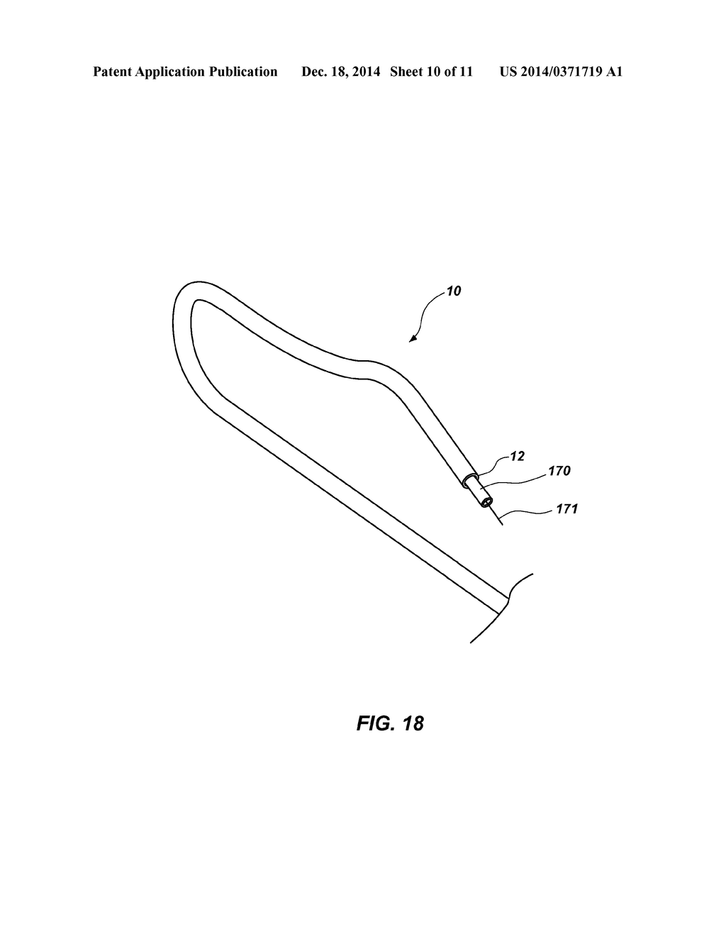 CATHETER AND METHODS RELATED THERETO - diagram, schematic, and image 11