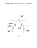 CATHETER AND METHODS RELATED THERETO diagram and image