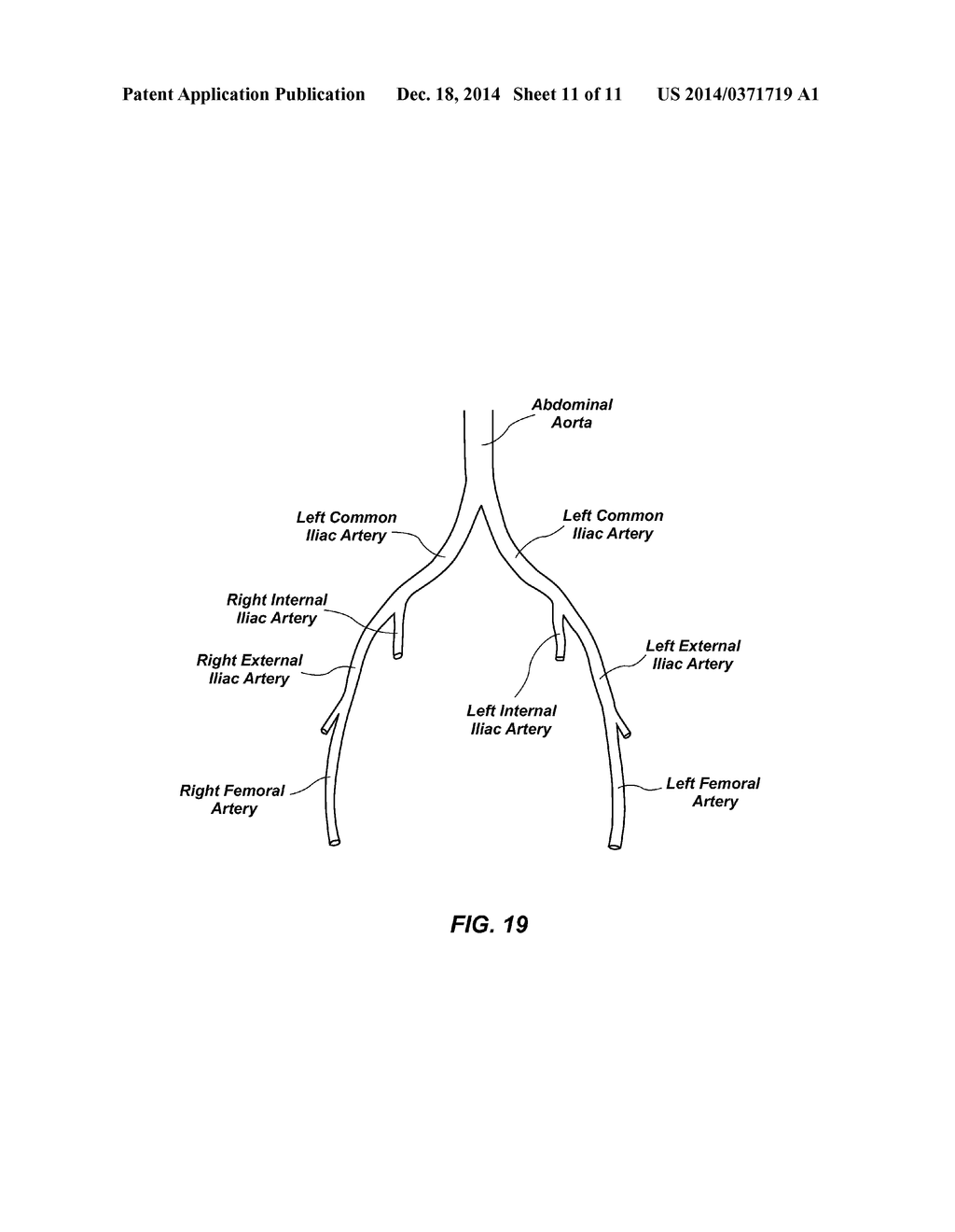 CATHETER AND METHODS RELATED THERETO - diagram, schematic, and image 12