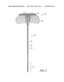 SYSTEMS FOR TREATING A VERTEBRAL BODY diagram and image