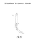 SYSTEMS FOR TREATING A VERTEBRAL BODY diagram and image