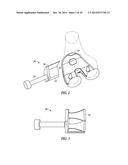 FEMORAL EXPLANT DEVICE diagram and image