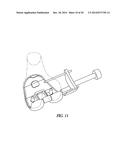 FEMORAL EXPLANT DEVICE diagram and image