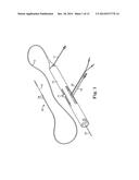 CONTROLLER FOR AN ATHERECTOMY DEVICE diagram and image