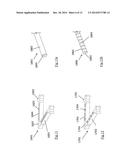 DEVICES AND METHODS FOR REMOVAL OF ACUTE BLOCKAGES FROM BLOOD VESSELS diagram and image