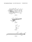 SUTURE PASSING SURGICAL INSTRUMENT diagram and image