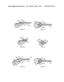 SUTURE PASSING SURGICAL INSTRUMENT diagram and image