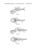 SUTURE PASSING SURGICAL INSTRUMENT diagram and image