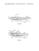 SUTURE PASSING SURGICAL INSTRUMENT diagram and image