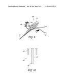 SUTURE FOR CONNECTING A HUMAN OR ANIMAL TISSUE, SOFT ANCHOR AND METHOD FOR     ATTACHING A TISSUE TO A BONE diagram and image