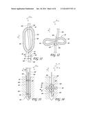 SUTURE FOR CONNECTING A HUMAN OR ANIMAL TISSUE, SOFT ANCHOR AND METHOD FOR     ATTACHING A TISSUE TO A BONE diagram and image