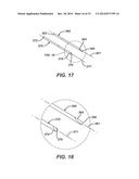 Bone Plate System And Method diagram and image