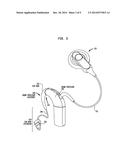 Sound Processor Accessory diagram and image