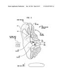 Sound Processor Accessory diagram and image