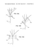 Dynamic Modification of Modulation Throughout a Therapy Period diagram and image