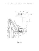 Dynamic Modification of Modulation Throughout a Therapy Period diagram and image