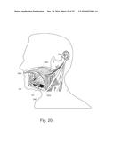 Dynamic Modification of Modulation Throughout a Therapy Period diagram and image