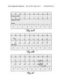 Detection of Implantable Lead Failures by Differential EGM Analysis diagram and image