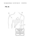 IMPLANTABLE ELECTRODE LOCATION SELECTION diagram and image