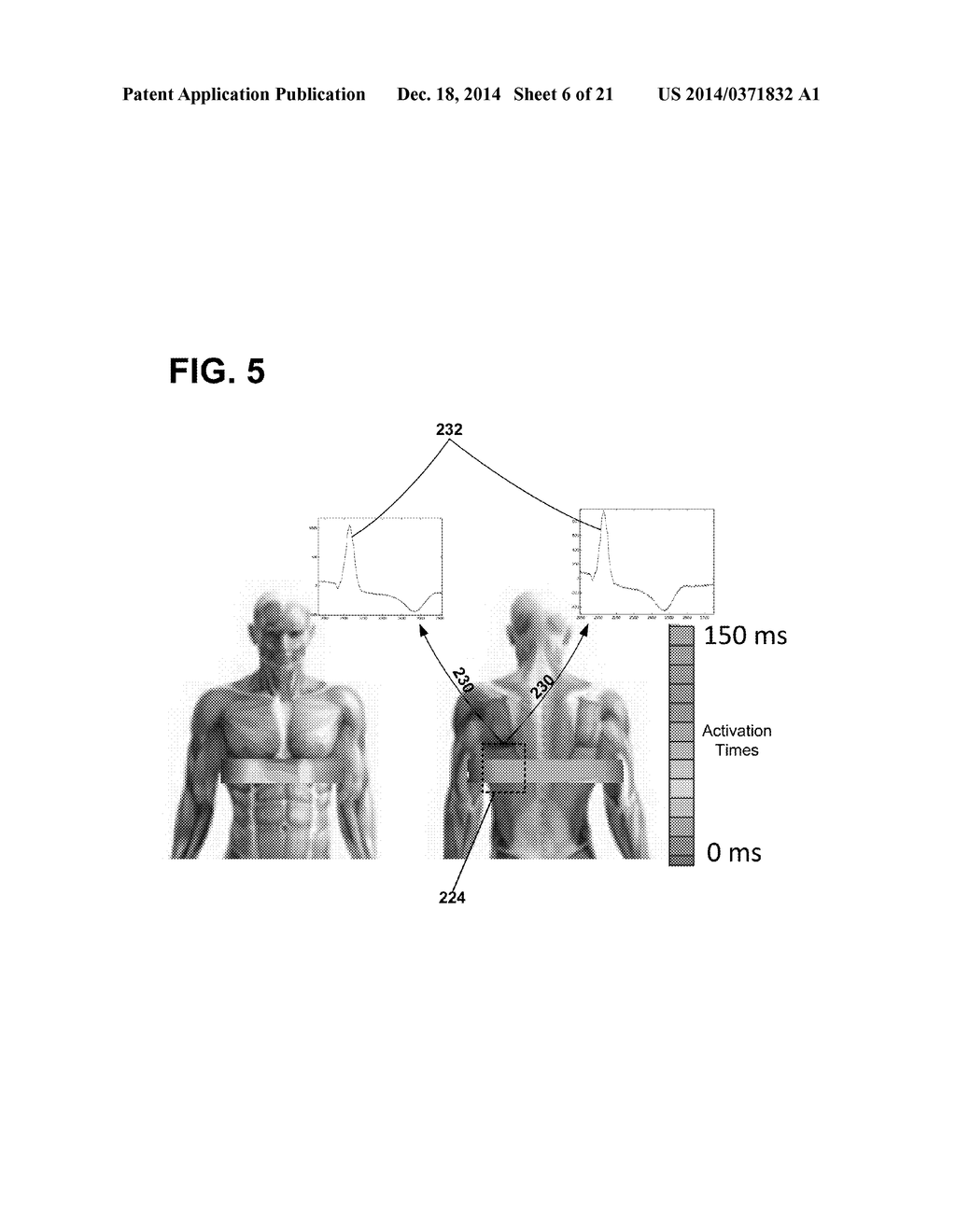 IMPLANTABLE ELECTRODE LOCATION SELECTION - diagram, schematic, and image 07