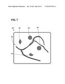 IMPLANTABLE ELECTRODE LOCATION SELECTION diagram and image