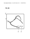 IMPLANTABLE ELECTRODE LOCATION SELECTION diagram and image