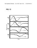 IMPLANTABLE ELECTRODE LOCATION SELECTION diagram and image