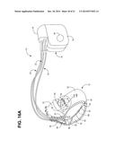 IMPLANTABLE ELECTRODE LOCATION SELECTION diagram and image