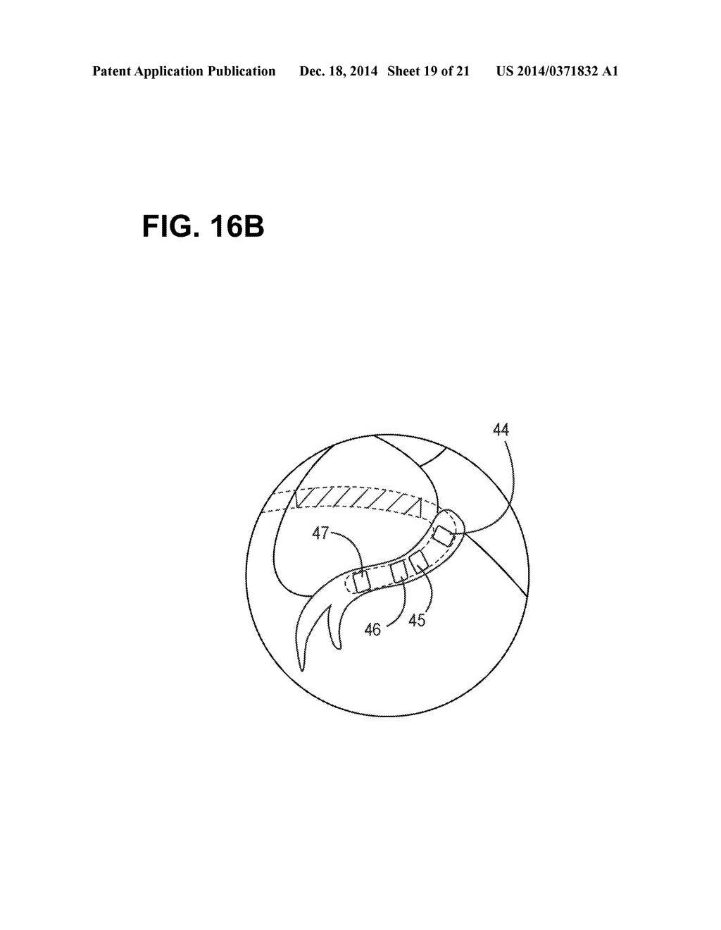 IMPLANTABLE ELECTRODE LOCATION SELECTION - diagram, schematic, and image 20