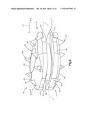 INTERVERTEBRAL IMPLANT diagram and image