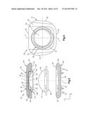 INTERVERTEBRAL IMPLANT diagram and image