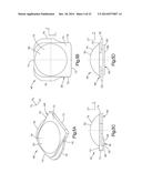 INTERVERTEBRAL IMPLANT diagram and image