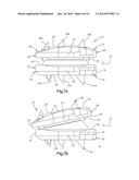 INTERVERTEBRAL IMPLANT diagram and image