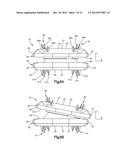 INTERVERTEBRAL IMPLANT diagram and image