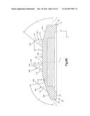 INTERVERTEBRAL IMPLANT diagram and image