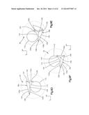 INTERVERTEBRAL IMPLANT diagram and image